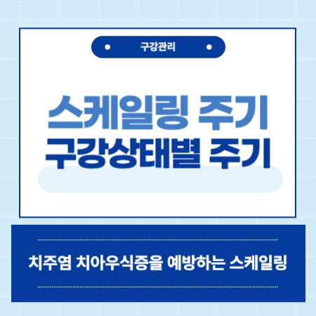 스케일링 주기 알아보기