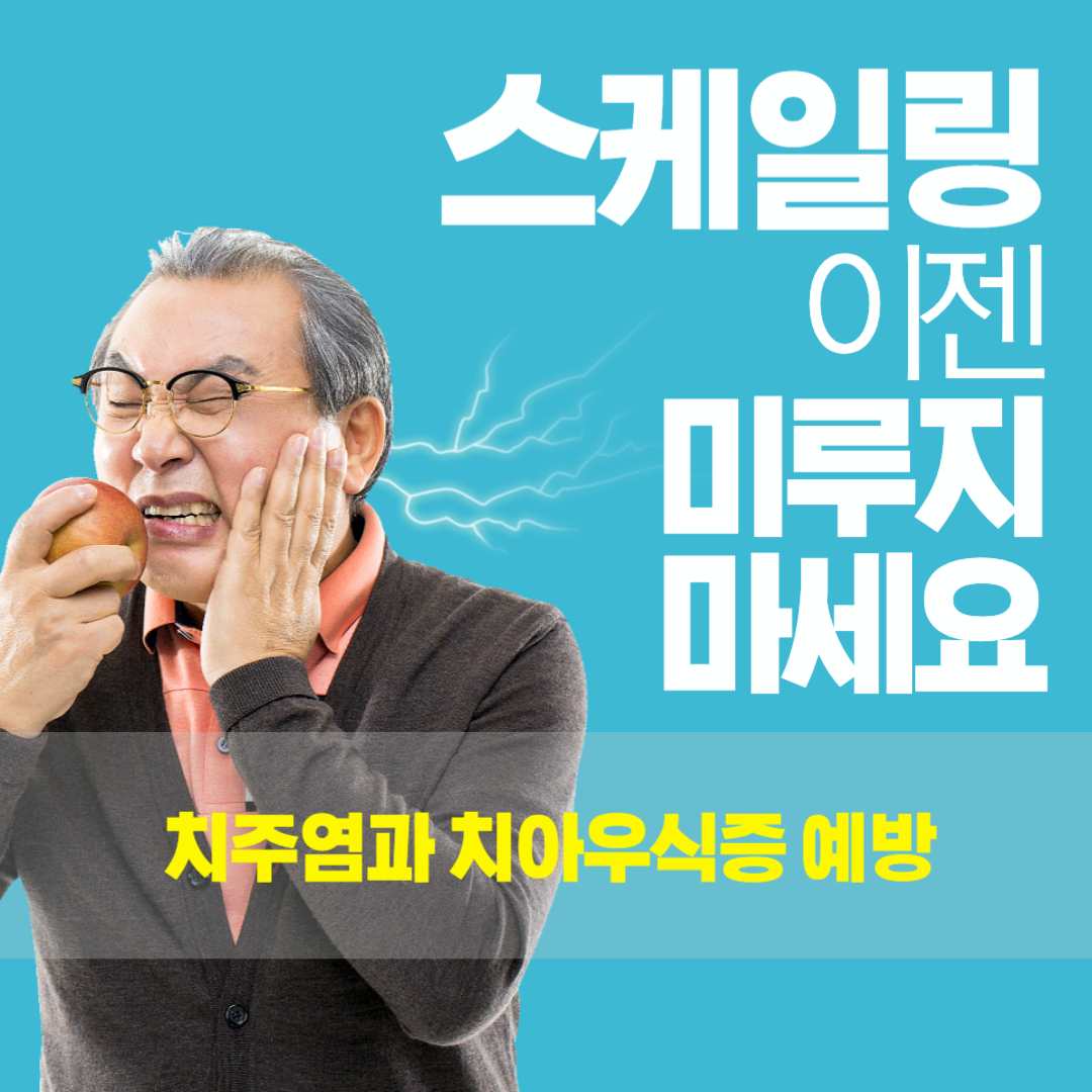 스케일링 주기